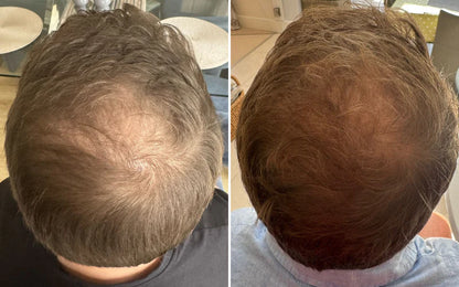 Electric LED Massage Comb