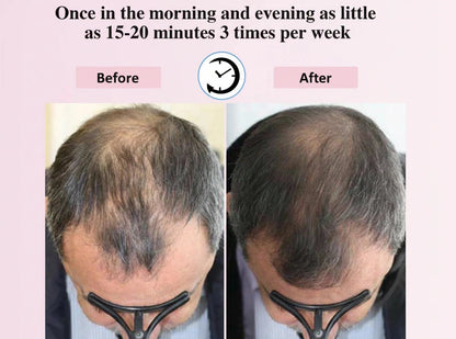 Electric LED Massage Comb