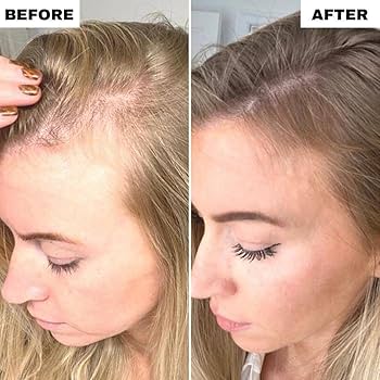 Electric LED Massage Comb