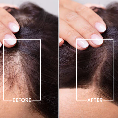 Electric LED Massage Comb