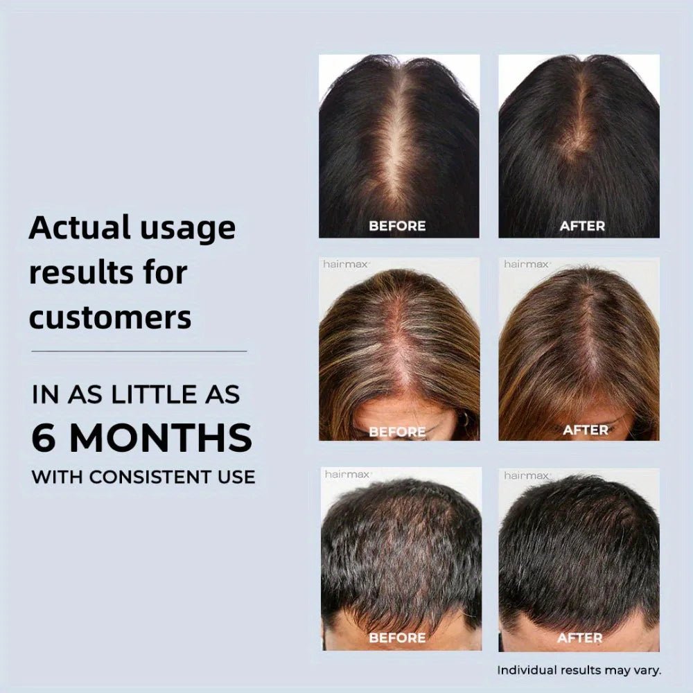 LED Light Hair Growth Therapy Hat For Hair Loss