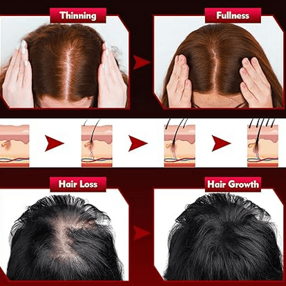 LED Light Hair Growth Therapy Hat For Hair Loss