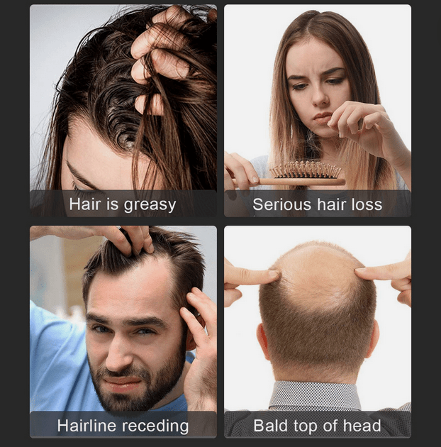 LED Light Hair Growth Therapy Hat For Hair Loss