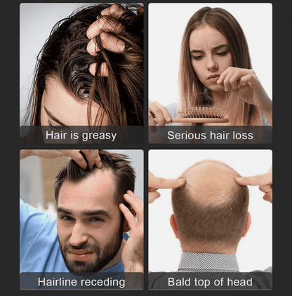 LED Light Hair Growth Therapy Hat For Hair Loss