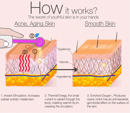 High Frequency Wand For Skin & Hair Loss